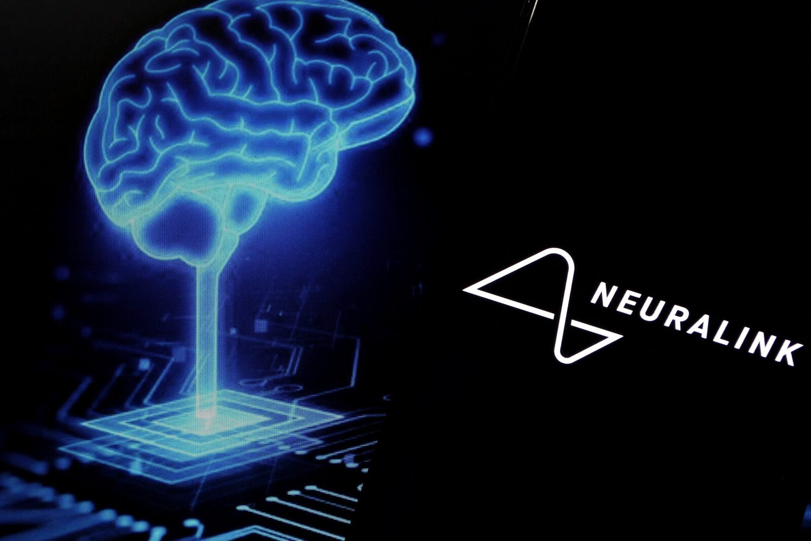 [ad_1] Compania Neuralink, specializată în dezvoltarea de implanturi cerebrale, pregătește lansarea unui studiu clinic pentru luna octombrie