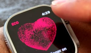 Cum identifică Apple Watch Series 11 și Ultra 3 hipertensiunea, afecțiune globală a secolului