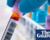 Scientists develop first ‘accurate blood test’ to detect chronic fatigue syndrome | ME / Chronic fatigue syndrome