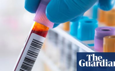 Scientists develop first ‘accurate blood test’ to detect chronic fatigue syndrome | ME / Chronic fatigue syndrome