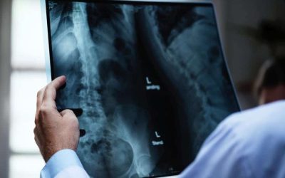 radiografie-plamani.jpeg