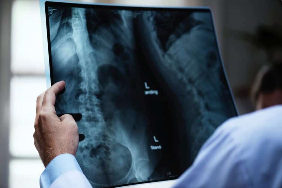 radiografie-plamani.jpeg