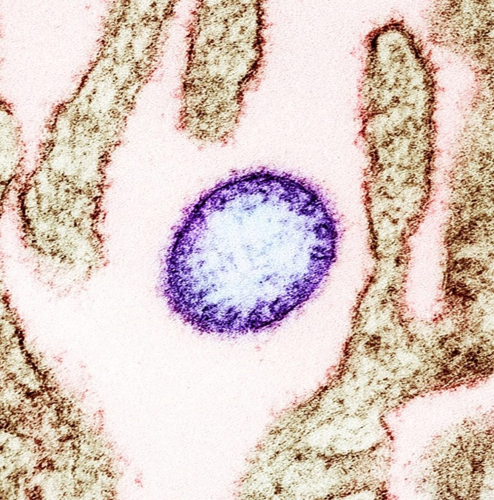 virus-Nipah.jpg