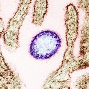 Riscul de răspândire a virusului mortal Nipah din India este considerat scăzut de către Organizația Mondială a Sănătății (OMS), care a emis recomandări oficiale după ce au fost raportate recent două cazuri de infectare în India