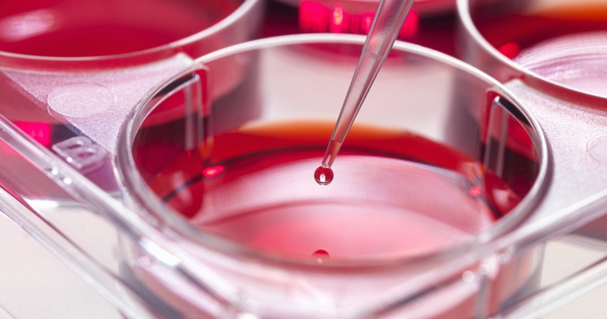 Știință: Mecanism descoperit pentru blocarea unei forme agresive de leucemie.