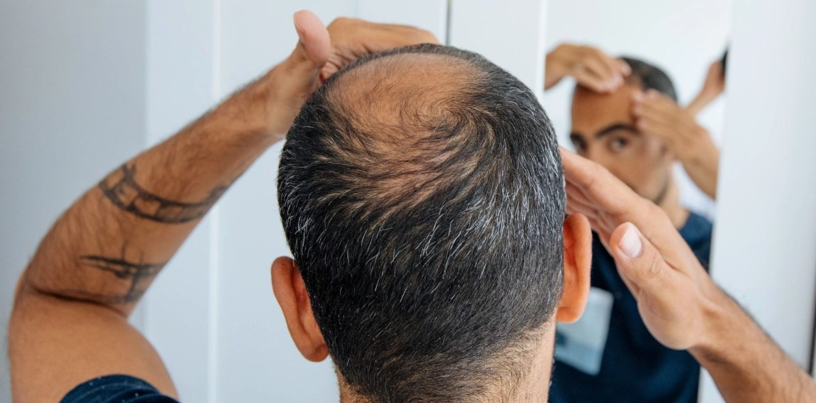 Oamenii de știință au reușit să creeze foliculi de păr funcționali în laborator Un nou studiu științific aduce speranțe pentru tratarea alopeciei, reușind să genereze foliculi de păr funcționali în laborator