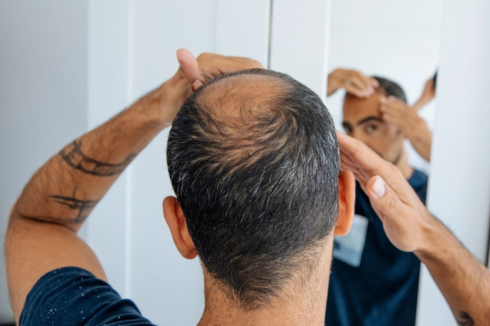 Oamenii de știință au reușit să creeze foliculi de păr funcționali în laborator Un nou studiu științific aduce speranțe pentru tratarea alopeciei, reușind să genereze foliculi de păr funcționali în laborator