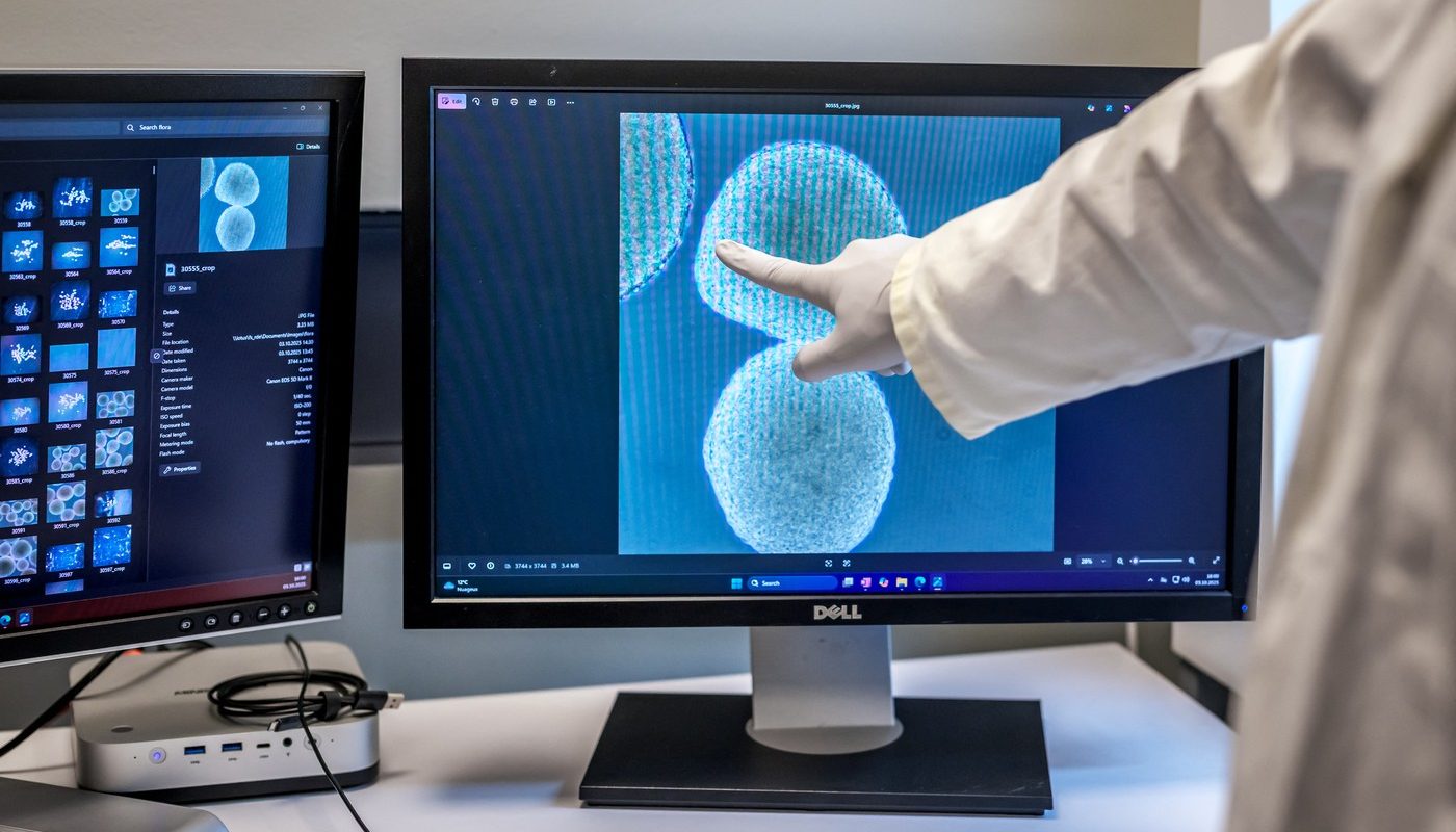 Creierul uman, o hartă pentru gânduri și amintiri Cercetătorii au descoperit că mecanismele cerebrale responsabile pentru orientarea spațială joacă un rol crucial în organizarea memoriei și a gândirii