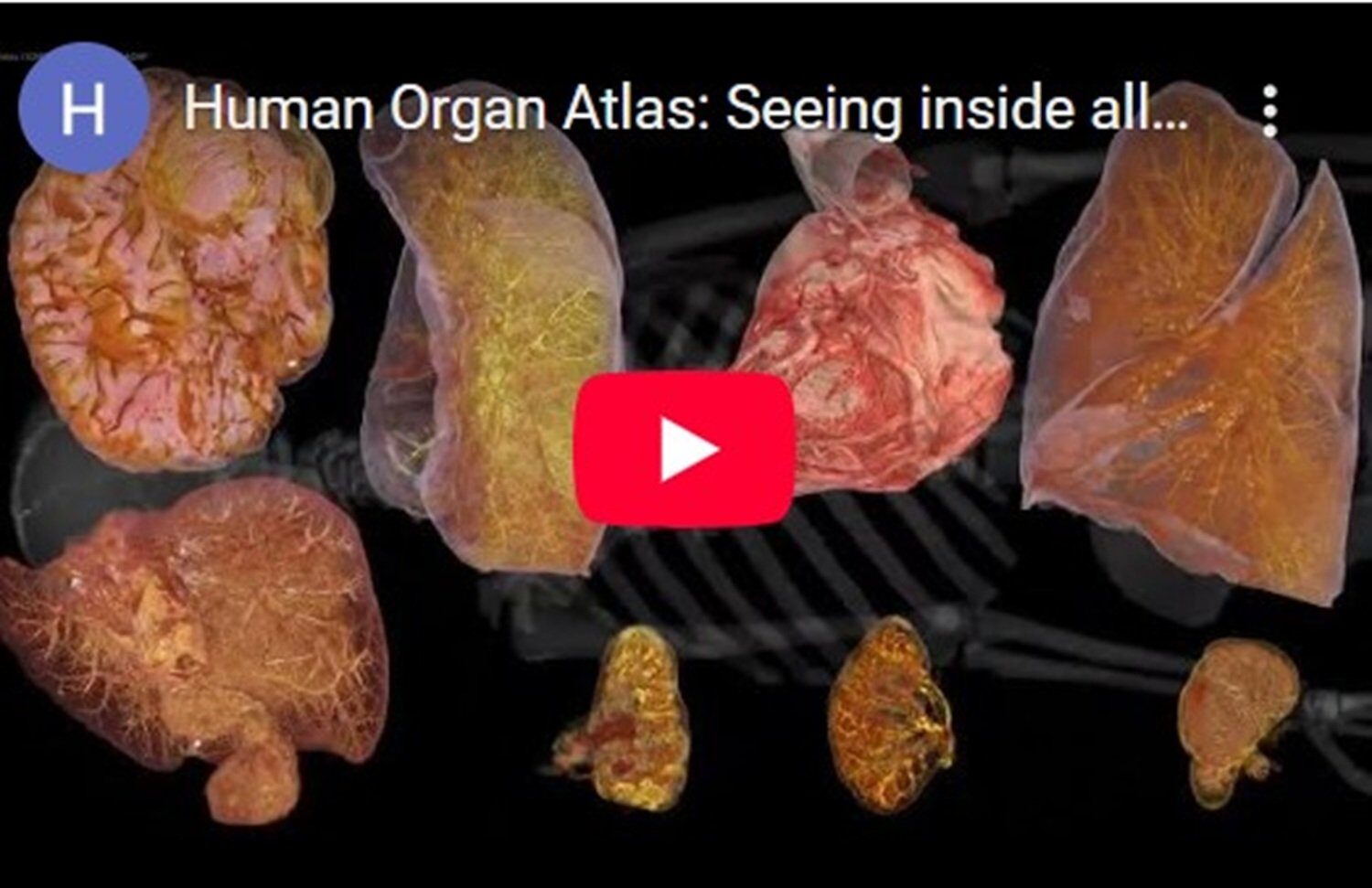 Un atlas digital al corpului uman, accesibil oricui, revoluționează studiul anatomiei Un proiect ambițios, rezultatul a șase ani de muncă, a fost publicat în revista Science Advances
