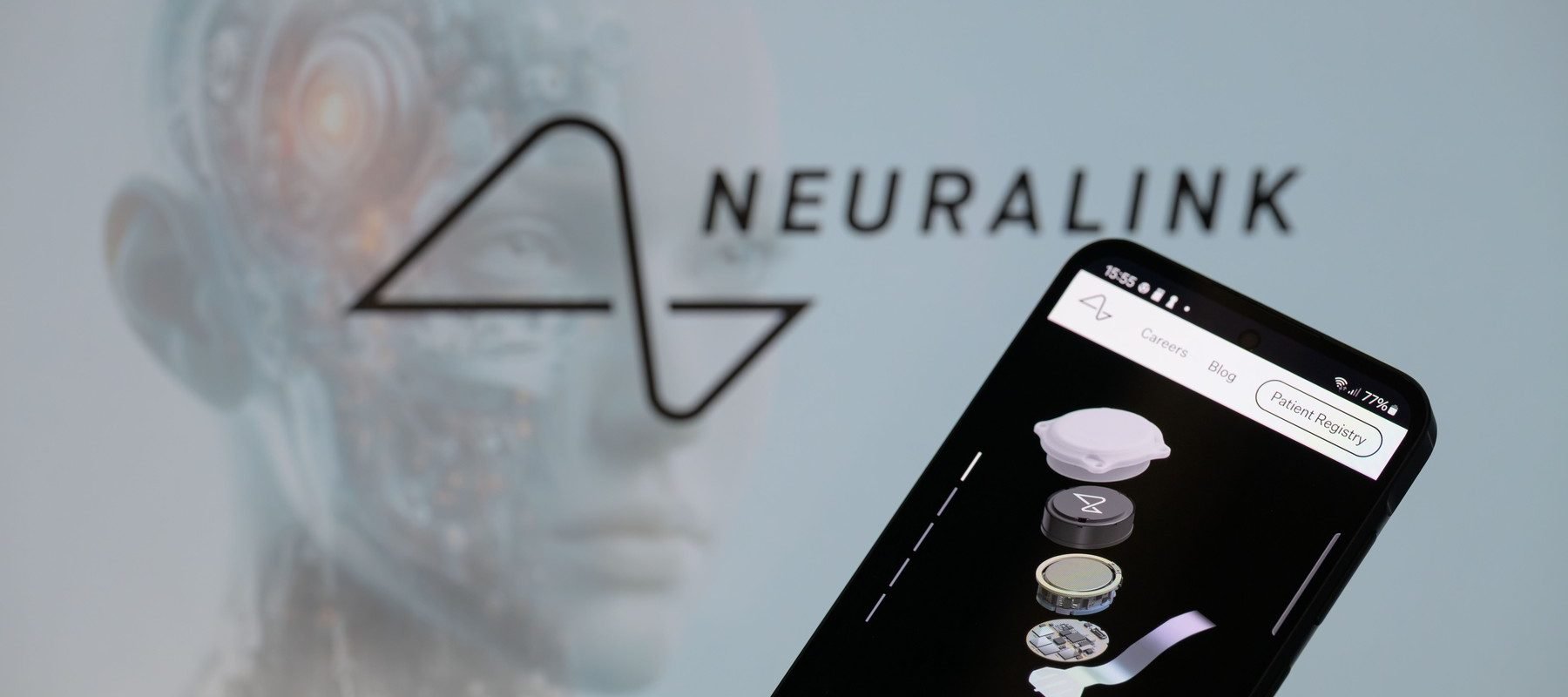 China dă undă verde primului implant cerebral comercial Shanghai, China – Autoritățile chineze au aprobat comercializarea primului implant cerebral dezvoltat de o companie locală, un pas important în dezvoltarea interfețelor creier-computer (BCI)