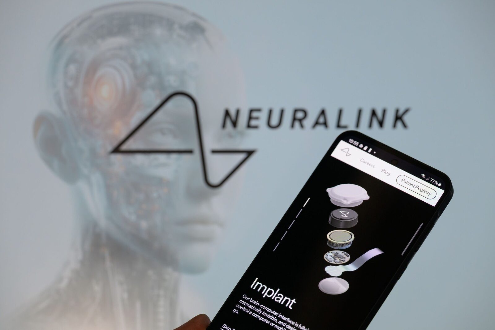 China dă undă verde primului implant cerebral comercial Shanghai, China – Autoritățile chineze au aprobat comercializarea primului implant cerebral dezvoltat de o companie locală, un pas important în dezvoltarea interfețelor creier-computer (BCI)