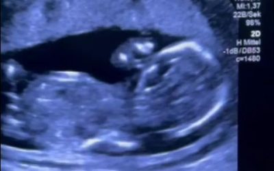 Gravidă, trimisă la tratament în Germania după o experiență traumatizantă la Filantropia din București