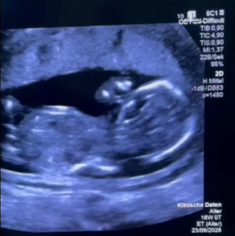 Gravidă, trimisă la tratament în Germania după o experiență traumatizantă la Filantropia din București