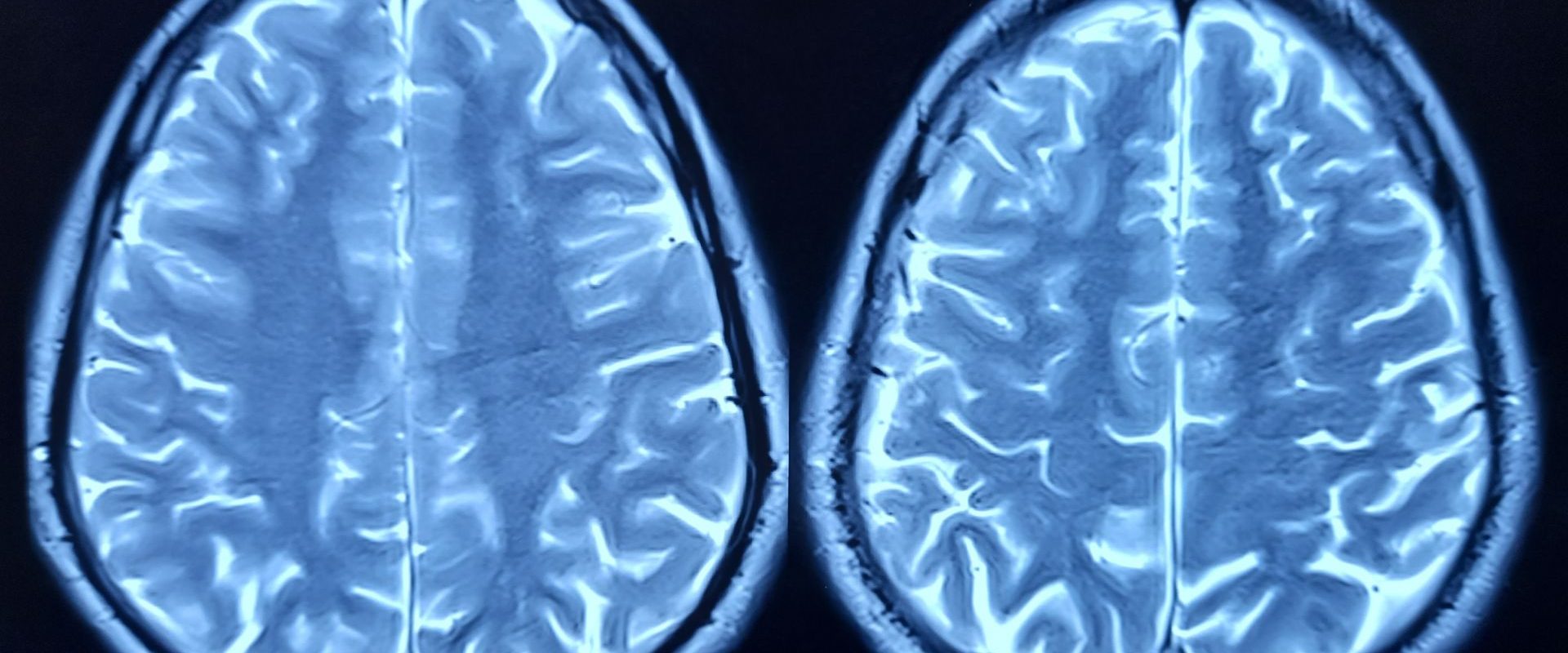 Oamenii de știință au aflat secretul îmbătrânirii creierului