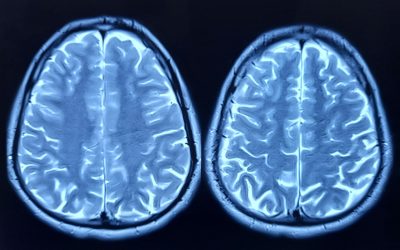 Oamenii de știință au aflat secretul îmbătrânirii creierului