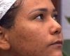 quais são os cuidados ideais para quem tem, como Chaiany, eliminada do 'BBB 26'? Cosmetóloga faz alerta e revela hábito indispensável na rotina de skincare