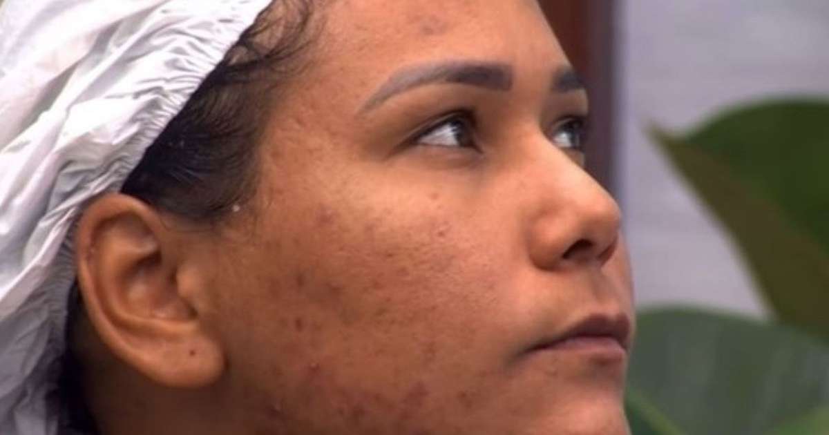 quais são os cuidados ideais para quem tem, como Chaiany, eliminada do 'BBB 26'? Cosmetóloga faz alerta e revela hábito indispensável na rotina de skincare