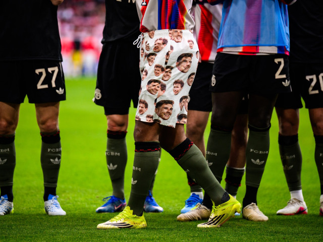 Șortul scandalos: Și-a afișat colegul pe posterior, chiar în fața lui