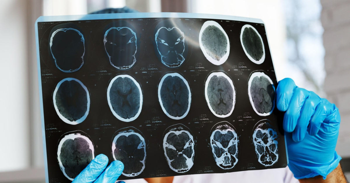 O scădere dramatică a accesului pacienților cronici la investigațiile vitale a declanșat o criză în sistemul medical