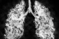 Vaporatul, un nou inamic: Cancer pulmonar și oral, riscuri majore!