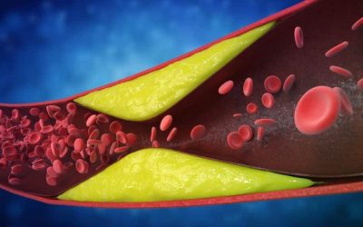 7 semne de infarct ignorate: Cardiologii avertizează, riscul e uriaș!