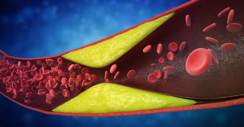 7 semne de infarct ignorate: Cardiologii avertizează, riscul e uriaș!