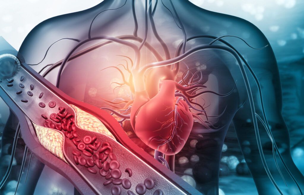 O simplă schimbare a stilului de viață poate reduce semnificativ riscul de infarct și accident vascular cerebral (AVC)