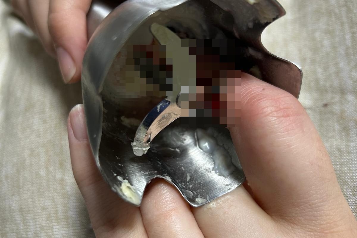 Două femei din Iași, la spital după accidente casnice grave