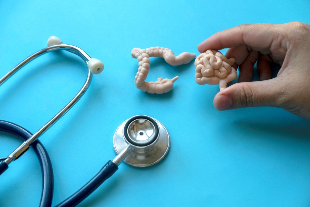 Cancerul de colon lovește tinerii: Fenomenul îngrijorător, cu efecte globale