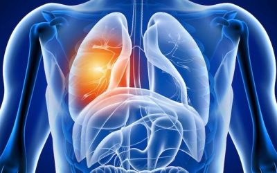 Răni nevăzute: Ce se întâmplă în plămâni după COVID-19 în România