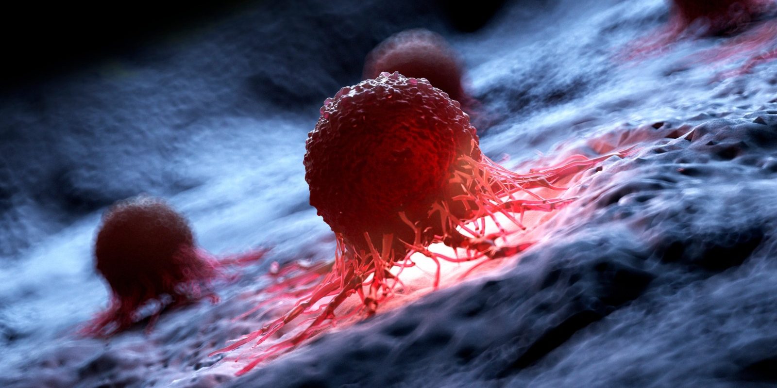 AI detectează cancerul de piele cu ani înainte, arată un studiu crucial