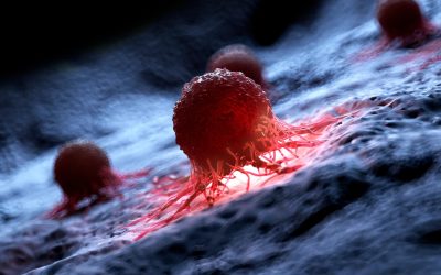 AI detectează cancerul de piele cu ani înainte, arată un studiu crucial