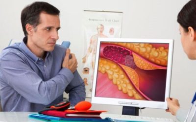 Nouă ghiduri american: Risc infarct și avc. Ce spun cardiologii despre colesterol