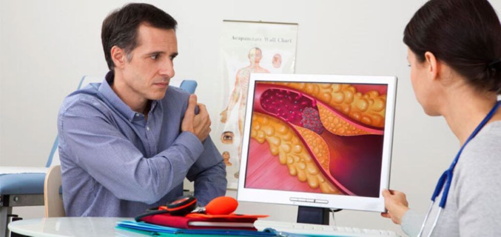 Nouă ghiduri american: Risc infarct și avc. Ce spun cardiologii despre colesterol