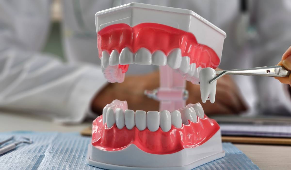 Extracție sau nu? Ce spun medicii ortodonți despre tratament