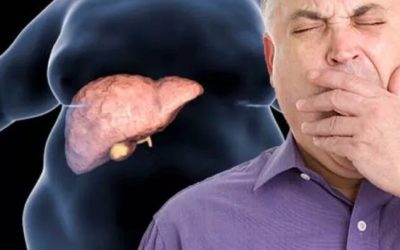 Boala ficatului gras: Tratament revoluționar, fără dietă nouă