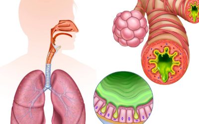 Inflamația cronică, „dușmanul invizibil”: Cum ne fură sănătatea