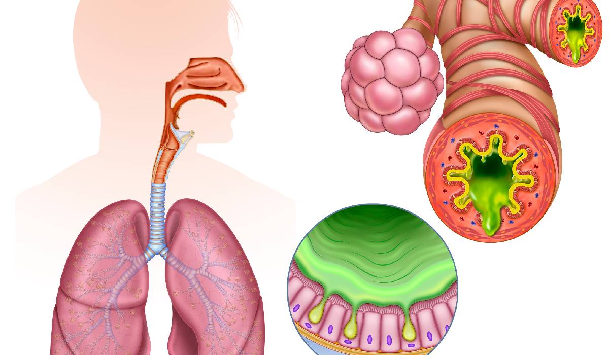 Inflamația cronică, „dușmanul invizibil”: Cum ne fură sănătatea