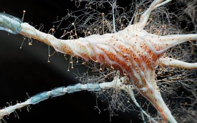 Inflamația intestinală, noua cauză a sclerozei multiple? Studiu ȘOC