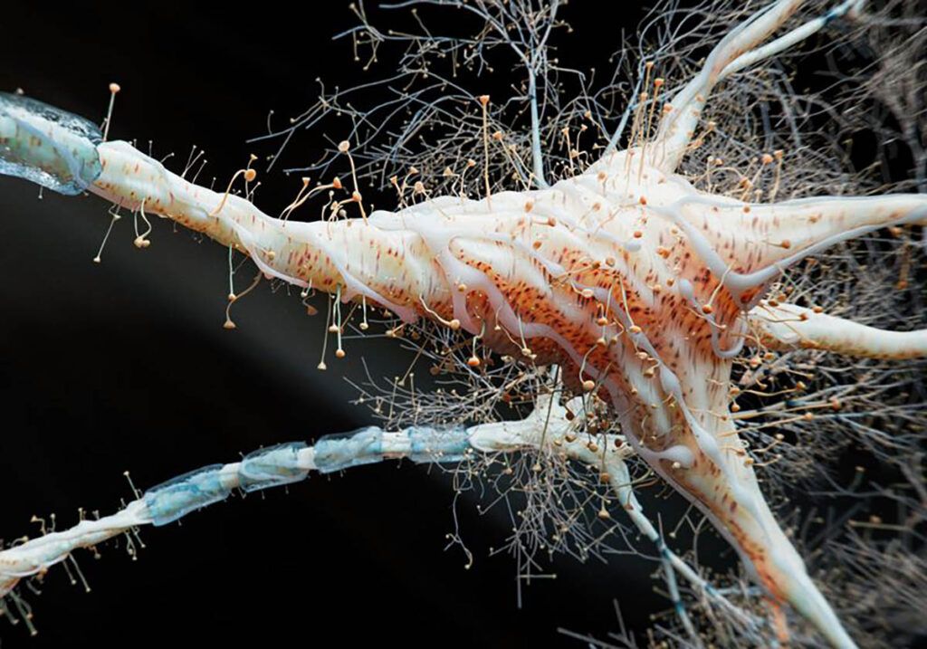 Inflamația intestinală, noua cauză a sclerozei multiple? Studiu ȘOC