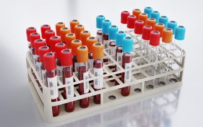 Analiză SÂNGELUI care poate PREZICE infarctul sau AVC, mai bine ca colesterolul