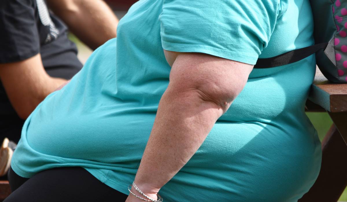 Obezitatea la 30 de ani: Riscul de moarte prematură crește cu 70%