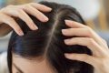 Probleme cu părul: Cauze ascunse pe care le ratezi. Află cum le depistezi!