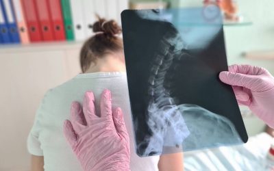 Greșeli de postură la copii: Ce trebuie să știe orice părinte despre coloană