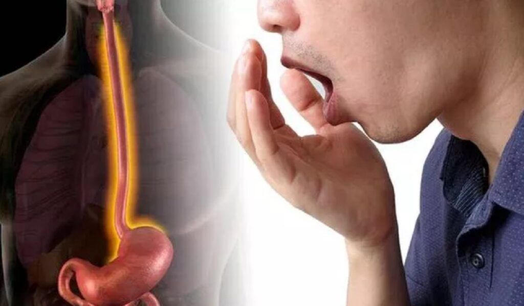 Jenant și subestimat: Simptomul SII care NU ține de digestie