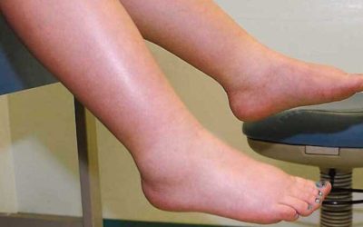 Leguma minune: Spune ADIO picioarelor umflate și circulației proaste!