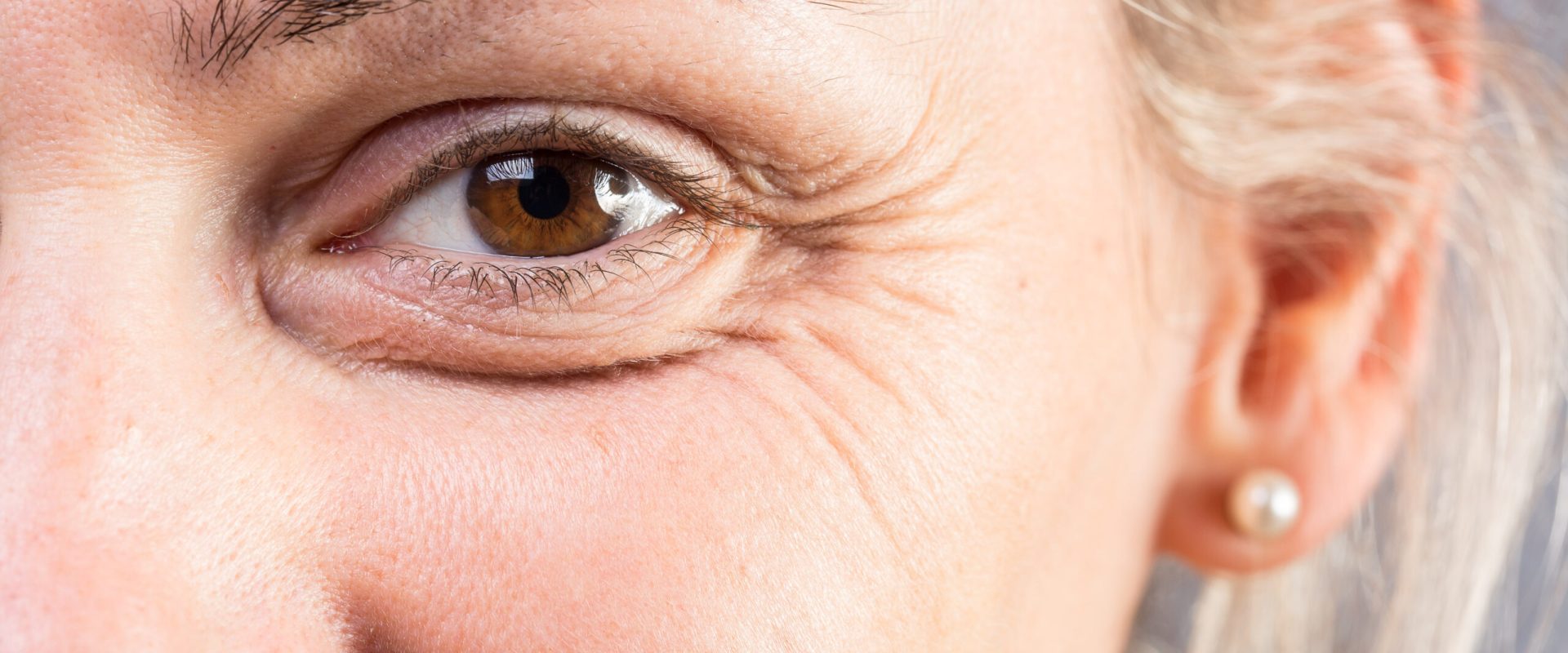 Ridurile, amprentele timpului: Îmbătrânire sau viață trăită din plin?