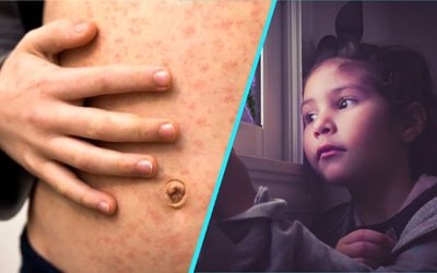 Rujeolă, gripă și vaccinare: Doctorița Sandra Alexiu, apel disperat