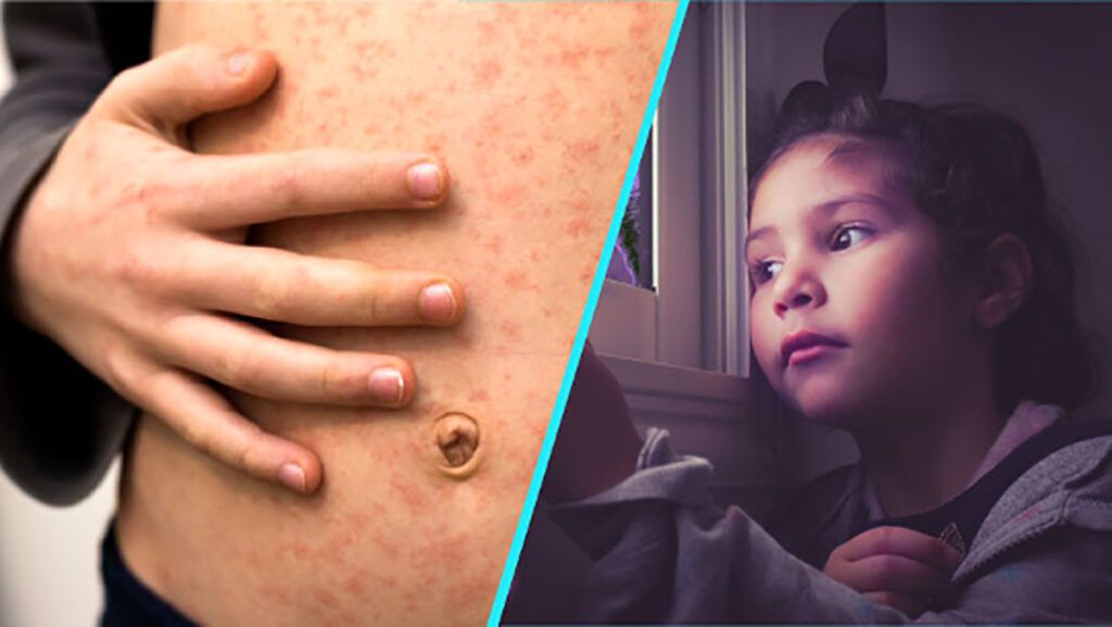 Rujeolă, gripă și vaccinare: Doctorița Sandra Alexiu, apel disperat