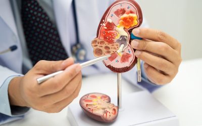 Acid uric vs. Creatinină: Ce dezvăluie analizele despre rinichi